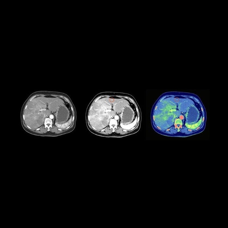 Спектральная КТ-система 256 срезов Revolution Discovery CT